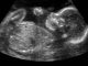 abortion, marion county, ocala news