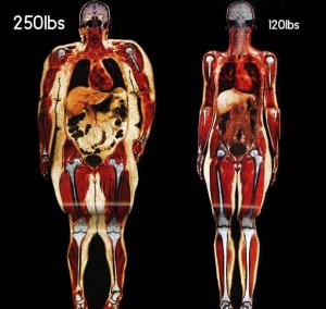 Americans are obese because they choose to be