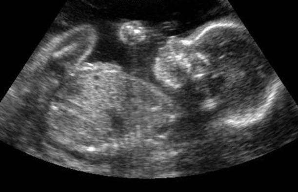 abortion, marion county, ocala news