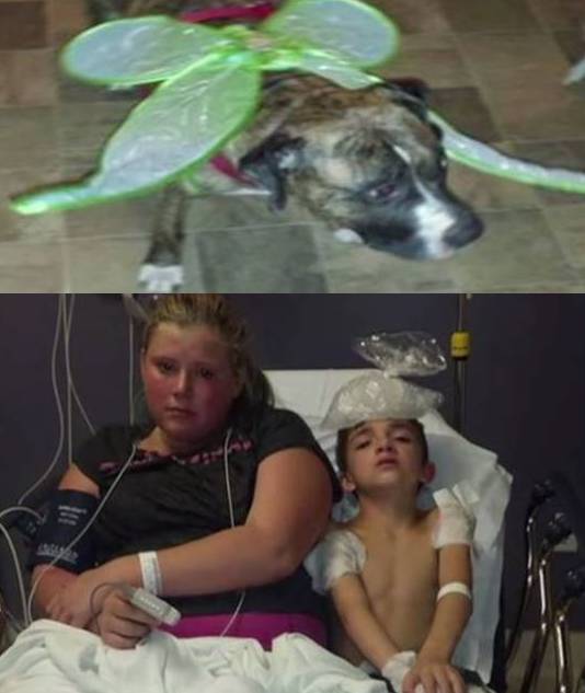 Pit bull saves boys life from bees