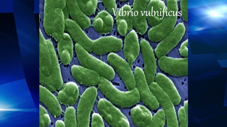 Vibrio vulnificus, florida, flesh eating bacteria, ocala news, marion county news