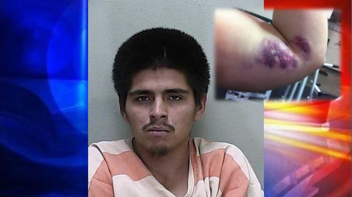 Illegal immigrant beats woman and attacks two deputies