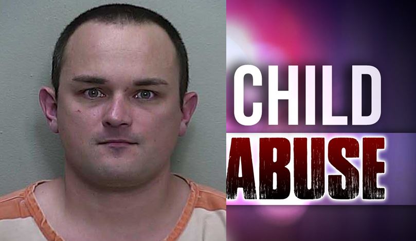 child abuse, ocala news, ocala post, child beating, baby