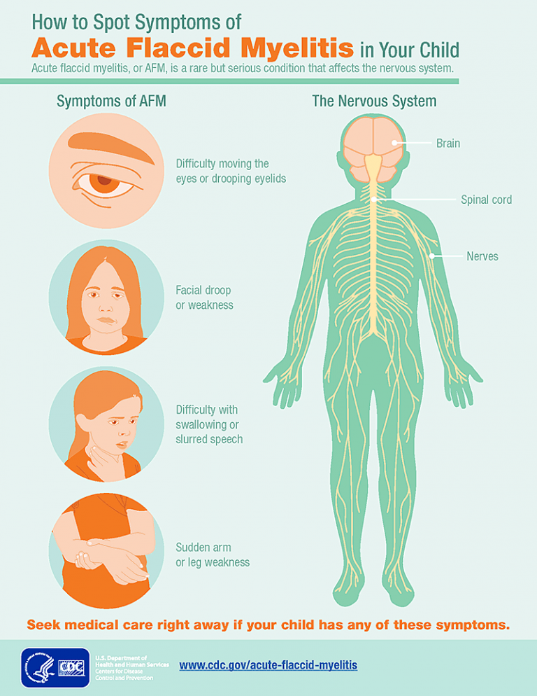 90 confirmed cases of Acute flaccid myelitis (AFM)