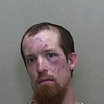 Boyfriend headedbutted girlfriend, punched her in the face